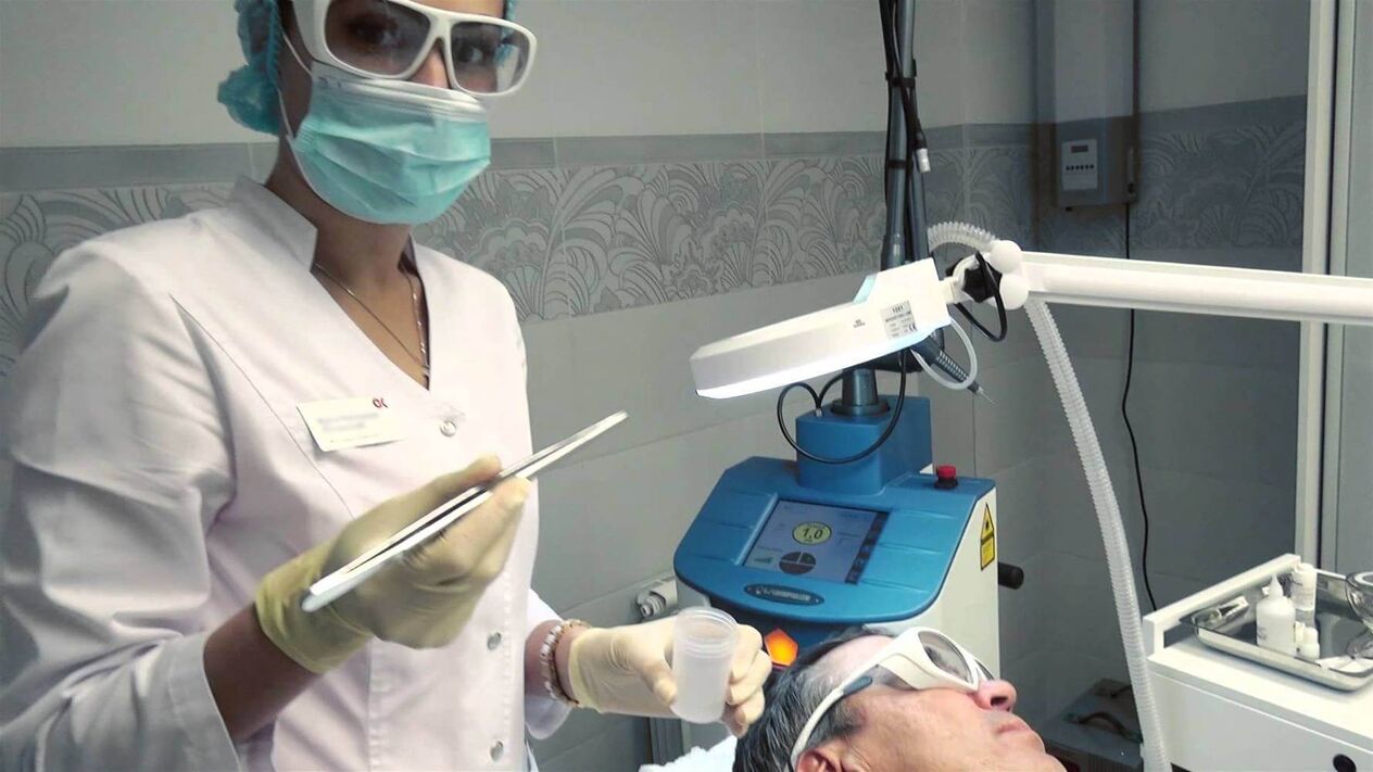 Preparação para procedimento de remoção de papilomas a laser